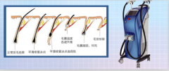 廣州脫毛儀器價(jià)格，脫毛一次多少錢，用什么儀器比較好？