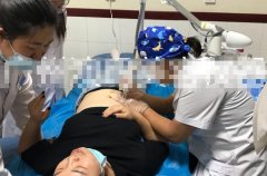 點陣激光設備哪個牌子好？國產點陣激光儀器_co2點陣激光治療儀品牌