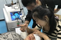 皮秒洗紋身機器哪家好？洗紋身最好的設備是哪種？皮秒洗紋身儀器